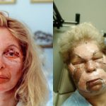 16 immagini mostrano quello che non si vede mai della chirurgia plastica