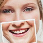 La penna sbiancante per denti funziona davvero?