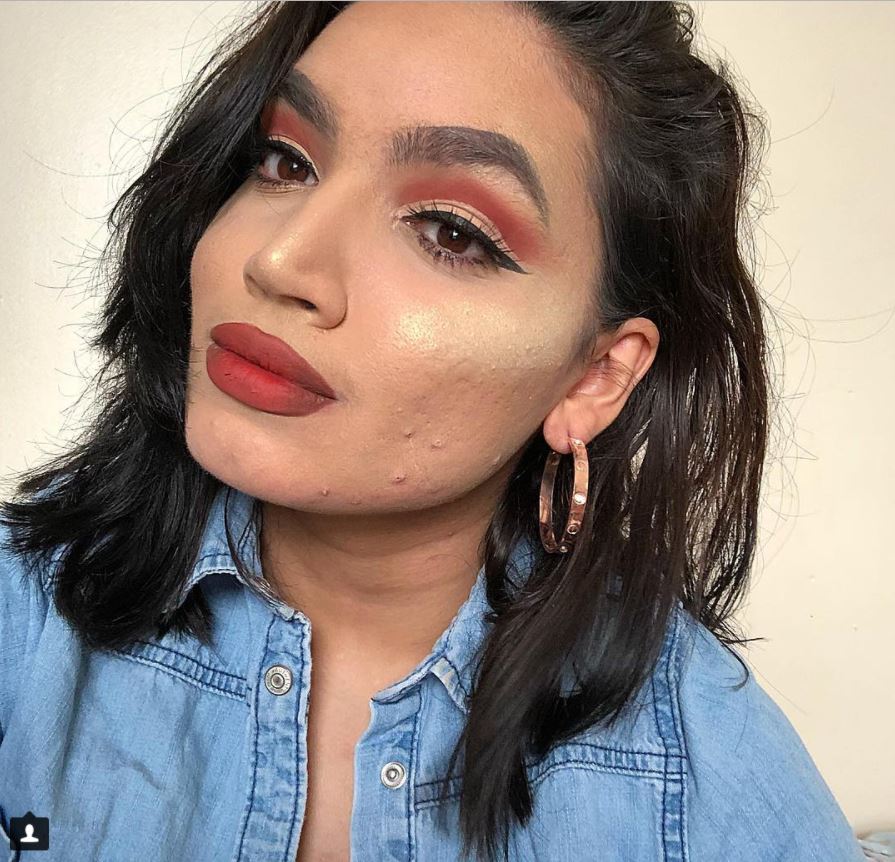 "La mia pelle non mi impedisce di amarmi ed essere una beauty blogger"