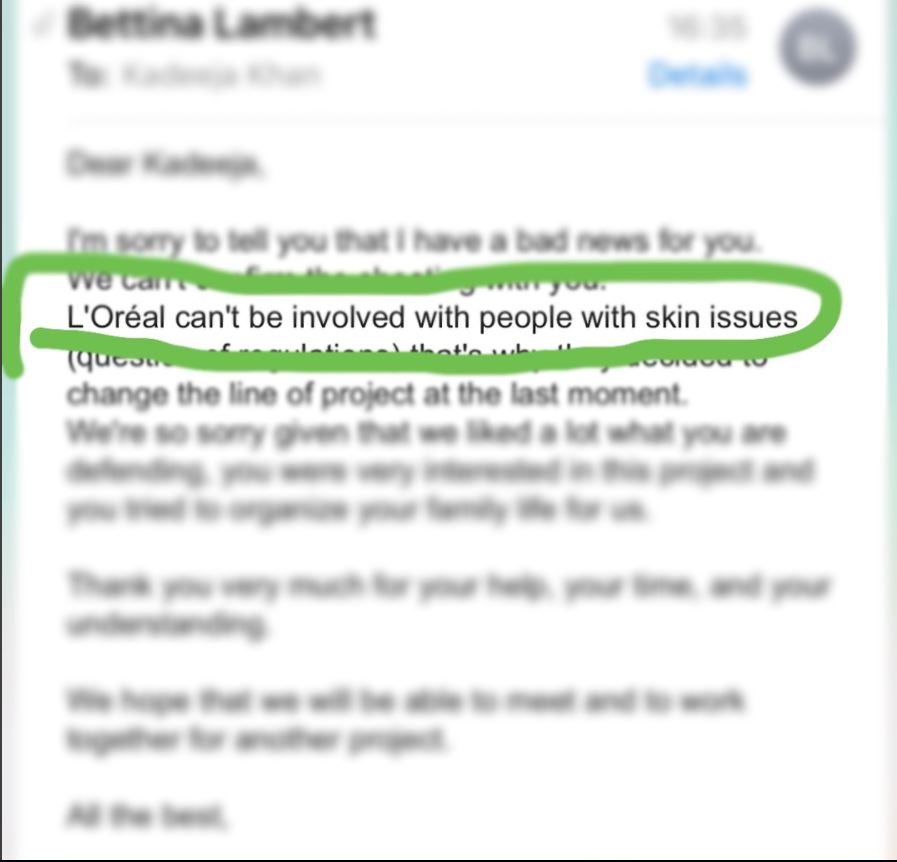 "La mia pelle non mi impedisce di amarmi ed essere una beauty blogger"