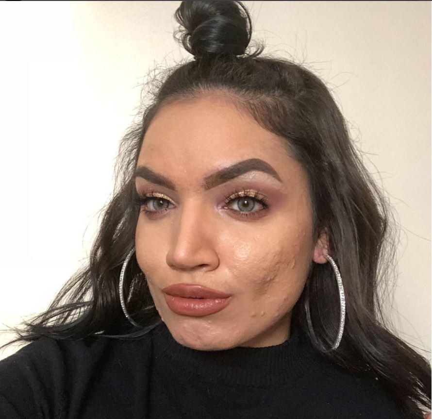"La mia pelle non mi impedisce di amarmi ed essere una beauty blogger"