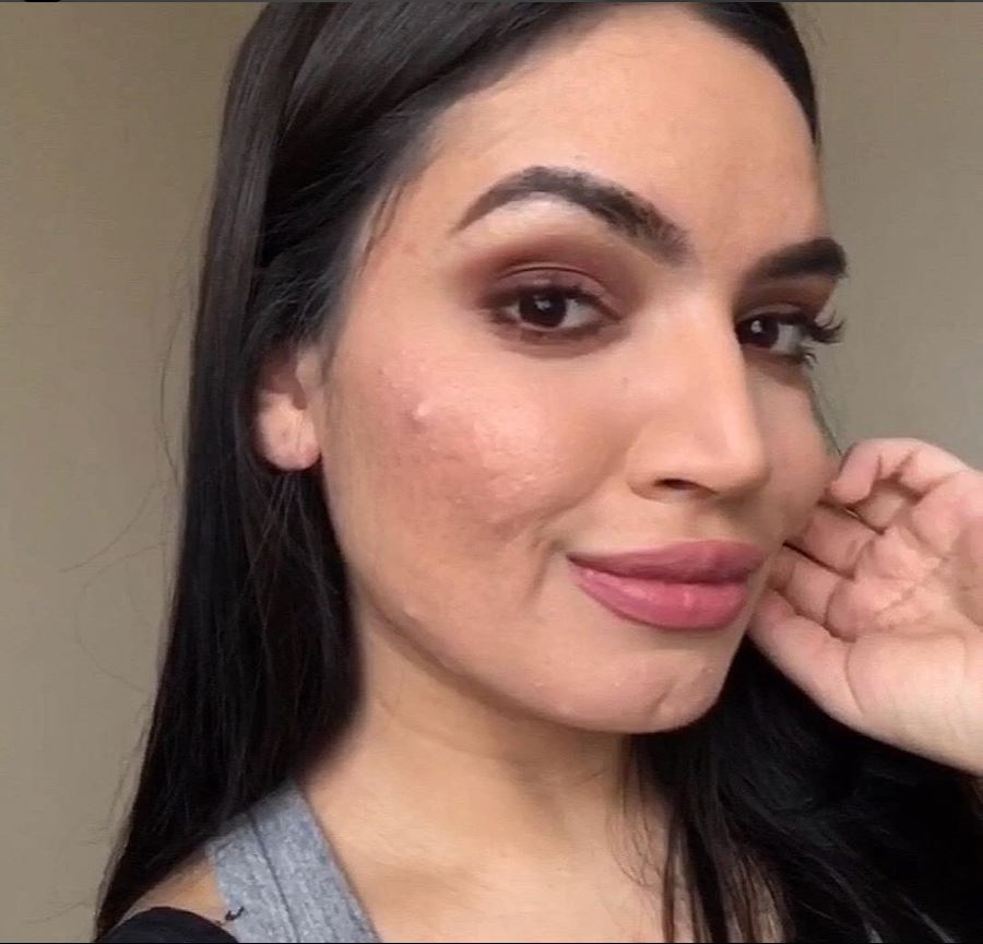 "La mia pelle non mi impedisce di amarmi ed essere una beauty blogger"
