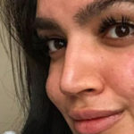 "La mia pelle non mi impedisce di amarmi ed essere una beauty blogger"