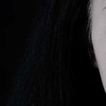 Laser frazionato: come funziona per viso e smagliature