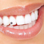 Brillantino al dente: l'accessorio perfetto per il tuo sorriso