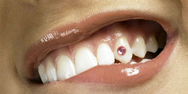 Brillantino al dente: consigli