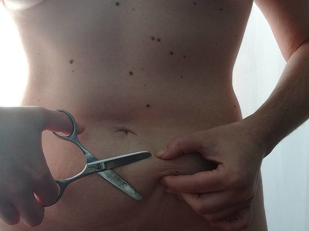 "Quanto è difficile imparare ad accettare che anche il nostro corpo sia bello"