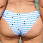 La bellezza di 9 star che mostrano la cellulite: "Cambiate la mente, non il corpo"