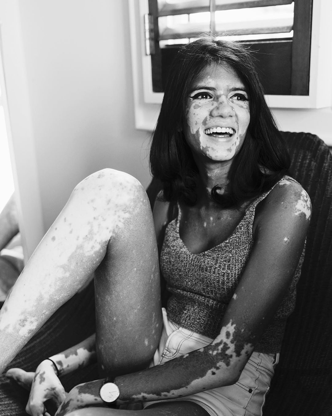 "Chi avrebbe mai amato questo mio corpo storto?"
