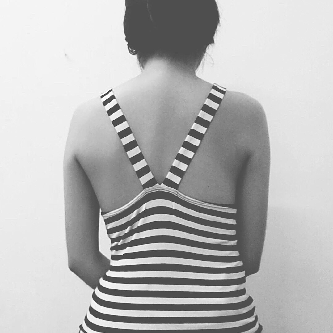 "Chi avrebbe mai amato questo mio corpo storto?"