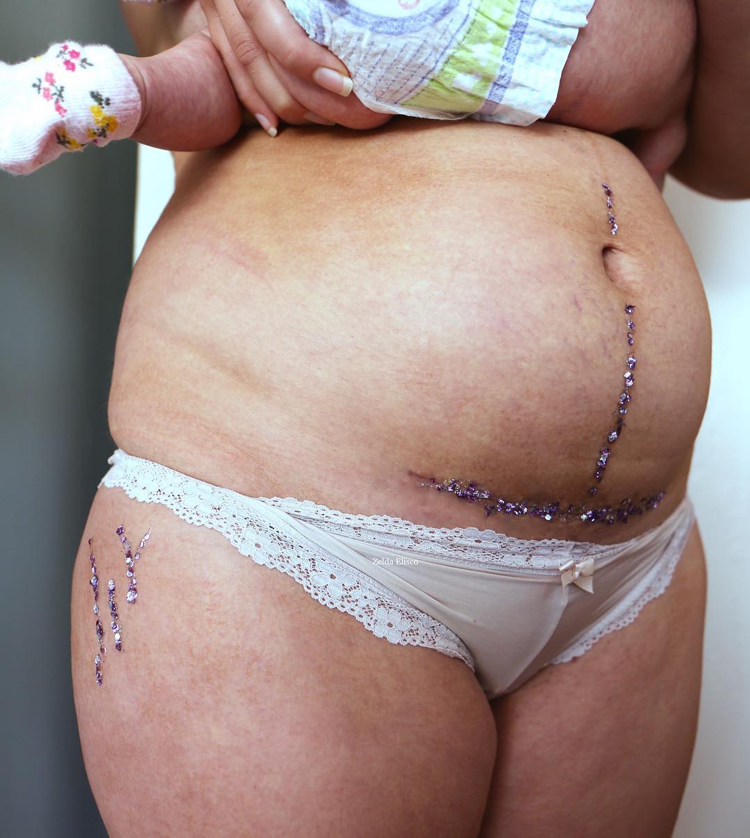 "Le smagliature sono belle: sono state con me in ogni lotta"