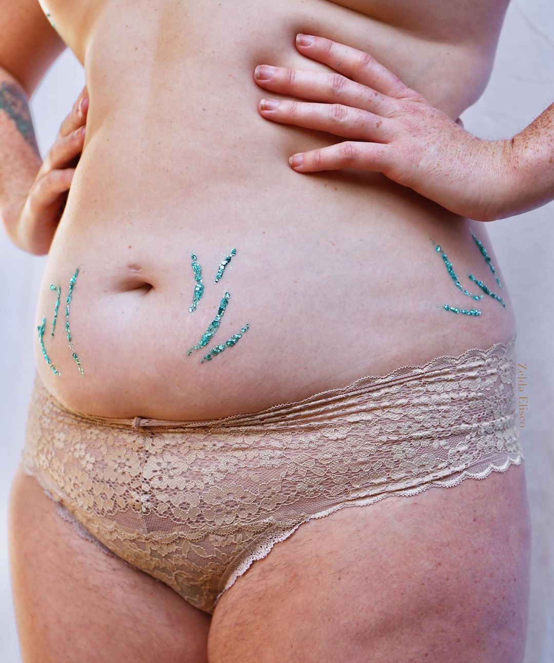 "Le smagliature sono belle: sono state con me in ogni lotta"