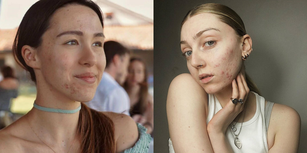 Marceau angouleme coiffure coiffures actrices celebmafia corti amica boum française rire modi portare besuchen celebrityrater theplace2 Skin positivity: come stiamo imparando ad amarci | Roba da Donne