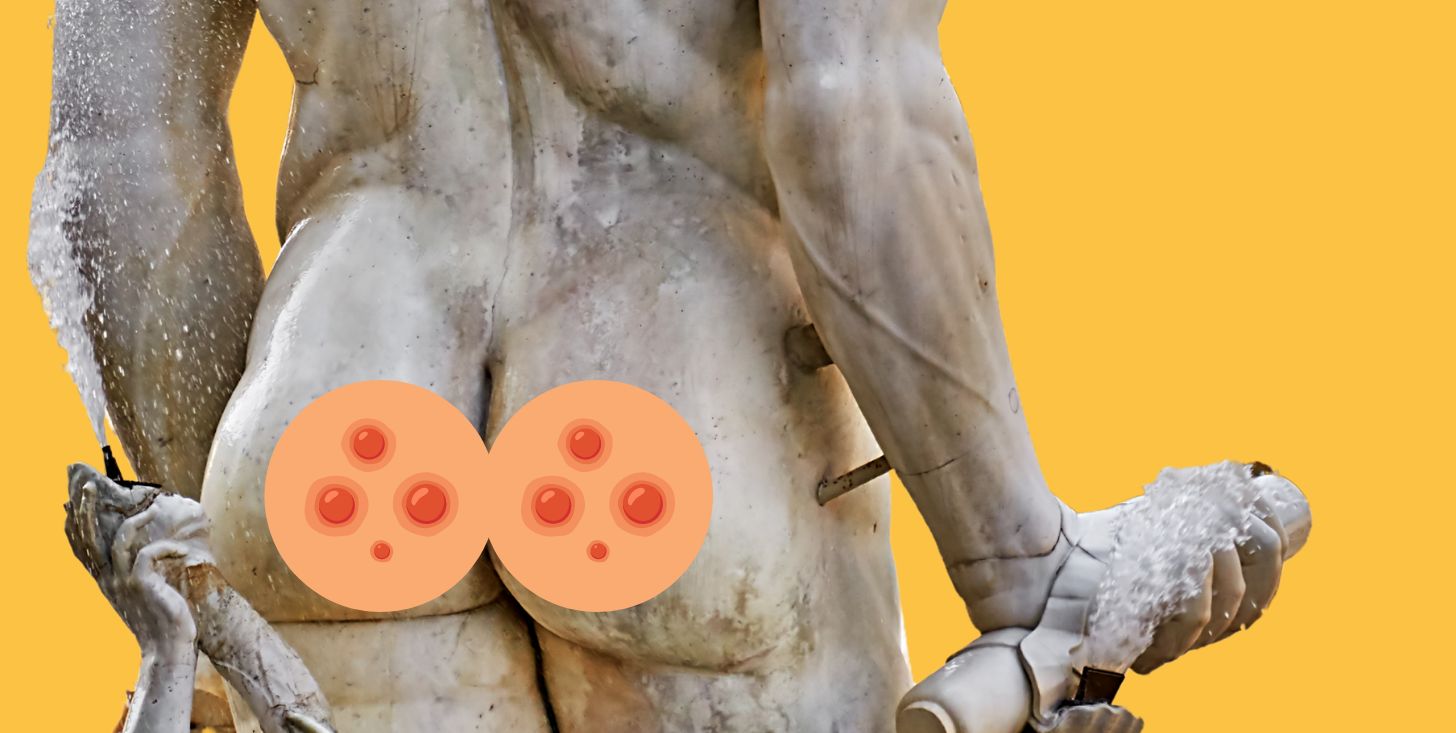 Brufoli sul sedere? È normale e trattabile. Come trattare l’acne sui glutei