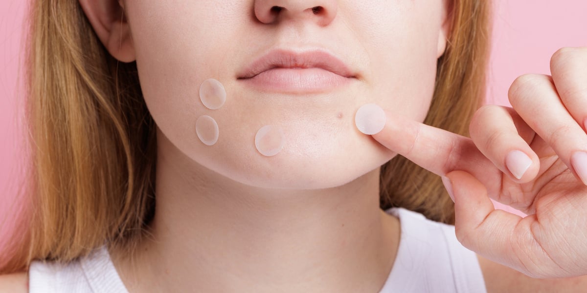 Pimple patches: come funzionano e guida ai migliori